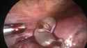 1744942497511554_thumb.jpg