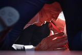 trump_bloody_cheek2