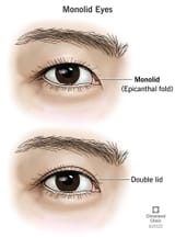 22413-monolid-eyes