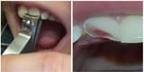 tooth