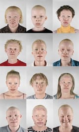 nigs albino