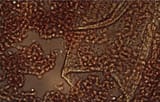 DrPhilippe-vaccinated-blood-magnetic