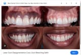 pajeet gums