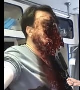 interestingcomplexion (100)