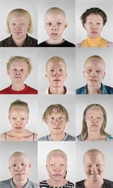 ugly albino niggers