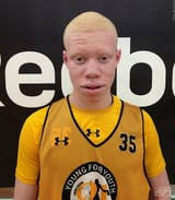 albino-9162281