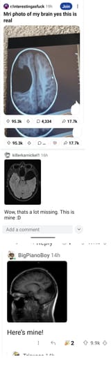 back 2 reddit 9