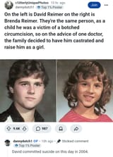 botched jew circ