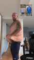 obese-loose-skin-cracker-4mb_thumb.jpg