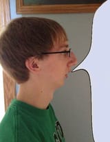 chinless chudcel