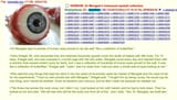 dr mengele holocaust eyeball