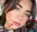 used herpes whore lujan