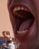 big mouth strikes again