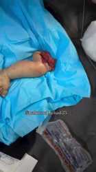 babby ripped_thumb.jpg
