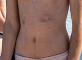 noadonisbelt