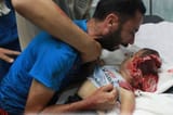 Palestinian brainless child
