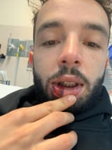 BLACKED