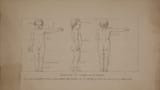 Unknown artist (Spanish 18th-19th c.) Anatomical proportions of the child figure from the front, profile, and back - ink on paper