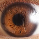 Human_eye_close_up,_anterior_view