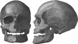 guanche skull
