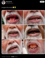 PM Modi’s teeth Poo 