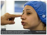 Iran nose job_capital