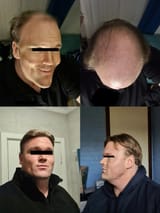 1732043687328454