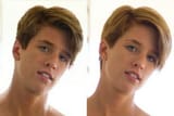 before after