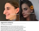jew before and after