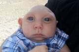 micro.cephaly.1613491481342