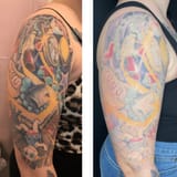 tattoo-removal-example-1