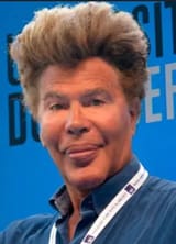 botoxface