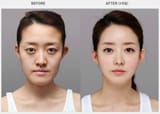 South_Korean_Plastic_Surgery