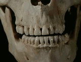 chewskull