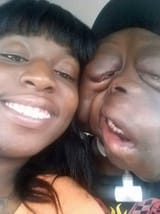 PAY-DEADLY-TUMOURS-RAVAGE-BOYS-FACE (1)