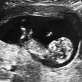 3_months_pregnant