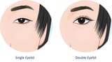 Single-vs-Double-Eyelid-266319392