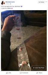 Pro Abortion