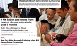 mohel jews