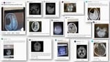 Reddit mri