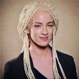 meron benti blue eyed ethiopian albino