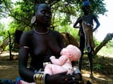 mursi albino