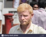 indian albino man