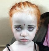 indian albino child
