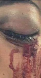 EyeballChunks