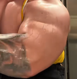 arm