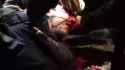 antifa hit in head with tear gas canister_thumb.jpg
