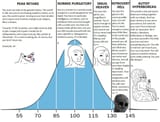 iq