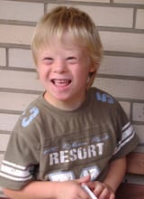 Boy_with_Down_Syndrome