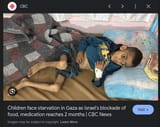 Screenshot 2025-07-04 at 10-05-16 starving kids gaza - Google Search
